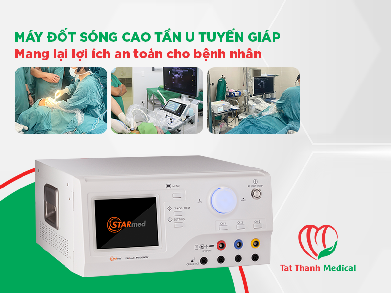 máy đốt sóng cao tần u tuyến giáp