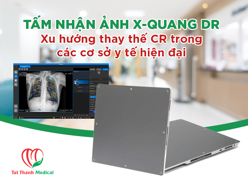 Tấm nhận ảnh X-quang DR - Xu hướng thay thế CR trong các cơ sở y tế hiện đại
