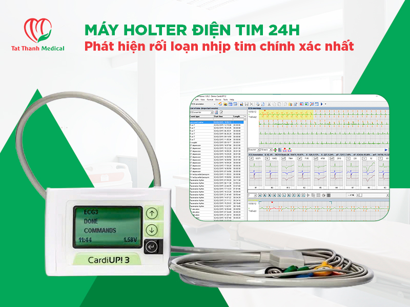 Máy Holter điện tim 24h: Giải pháp theo dõi nhịp tim liên tục và chẩn đoán rối loạn nhịp tim chính xác