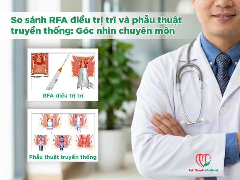 So sánh RFA điều trị trĩ và phẫu thuật truyền thống: Góc nhìn chuyên môn