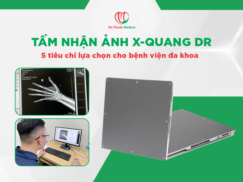Tấm nhận ảnh X-quang DR: 5 tiêu chí lựa chọn cho bệnh viện đa khoa