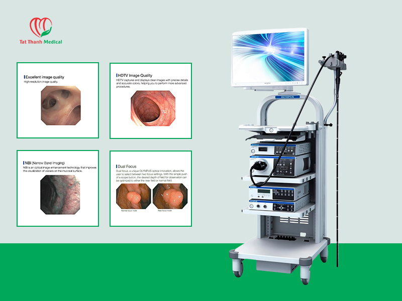 Nội soi tiêu hóa Olympus độ phân giải cao: Lợi thế cạnh tranh cho phòng khám