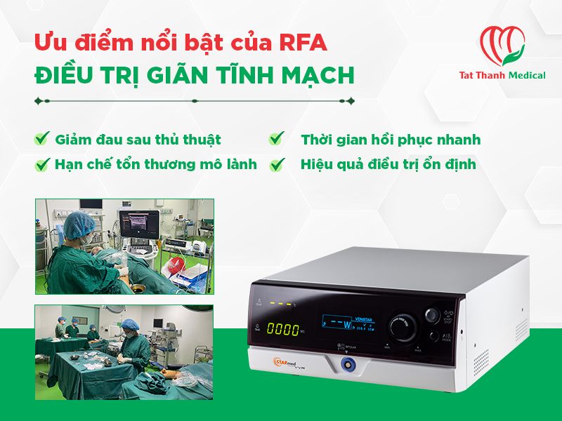 RFA điều trị giãn tĩnh mạch: Vì sao đang thay thế laser nội tĩnh mạch?