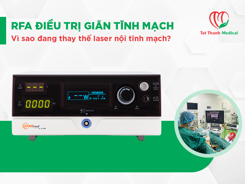 RFA điều trị giãn tĩnh mạch: Vì sao đang thay thế laser nội tĩnh mạch?