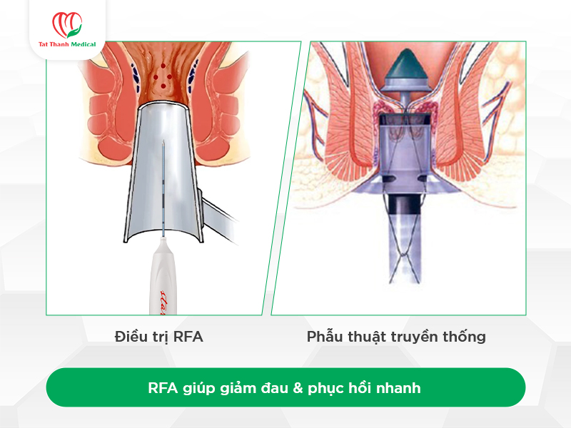 Quy trình theo dõi sau thủ thuật góp phần nâng cao hiệu quả lâu dài