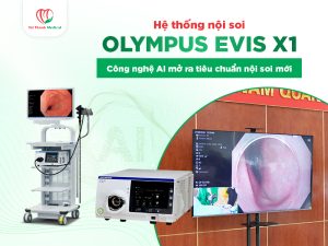 Hệ thống nội soi Olympus EVIS X1 - Thay đổi tiêu chuẩn chẩn đoán nội soi