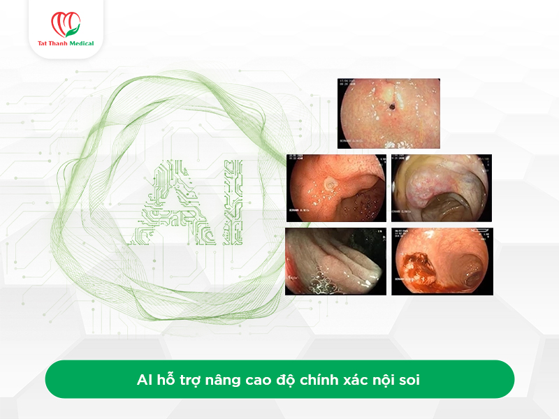 Vai trò của AI trong nội soi tiêu hóa hiện đại
