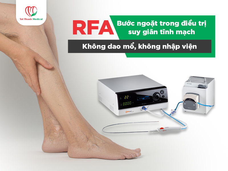 RFA - Bước ngoặt trong điều trị suy giãn tĩnh mạch: Không dao mổ, không nhập viện