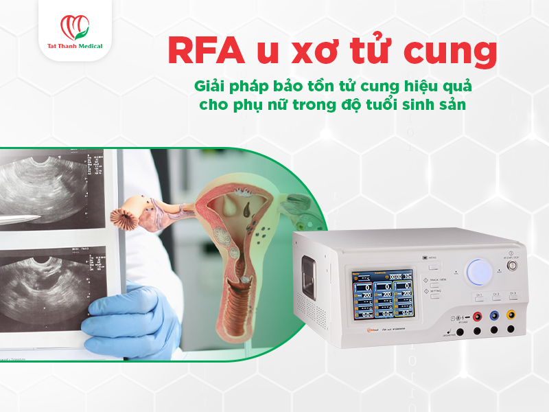 RFA u xơ tử cung - Giải pháp bảo tồn tử cung hiệu quả cho phụ nữ trong độ tuổi sinh sản