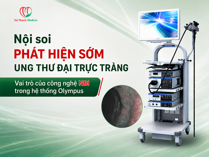 Nội soi phát hiện sớm ung thư đại trực tràng