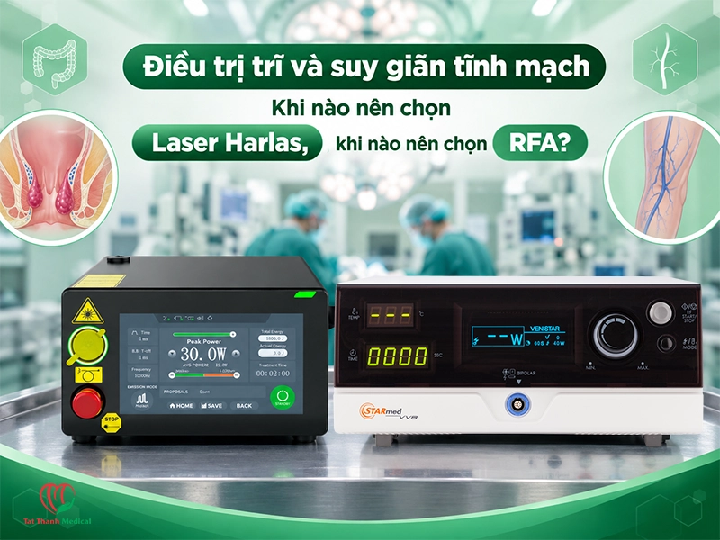 Điều trị trĩ và suy giãn tĩnh mạch: Khi nào nên chọn Laser Harlas, khi nào nên chọn RFA?