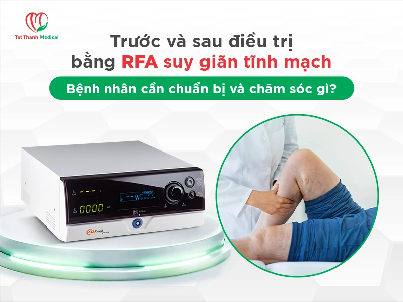 Trước và sau điều trị bằng RFA suy giãn tĩnh mạch: Bệnh nhân cần chuẩn bị và chăm sóc gì?