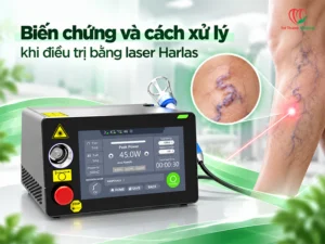 Biến chứng và cách xử lý khi điều trị bằng laser Harlas
