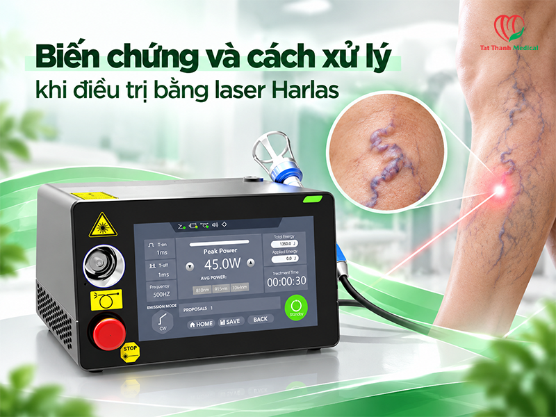 Biến chứng và cách xử lý khi điều trị bằng laser Harlas