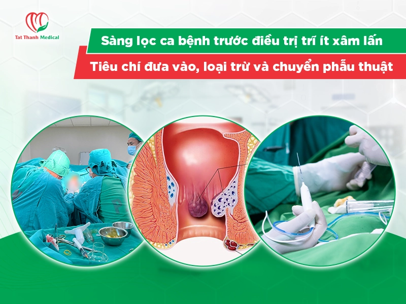 Sàng lọc ca bệnh trước điều trị trĩ ít xâm lấn: Tiêu chí đưa vào, loại trừ và chuyển phẫu thuật